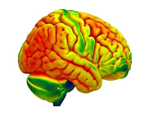 brainAD