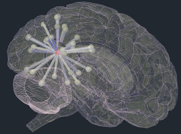 New publication by Thomas Cope et al., in Brain